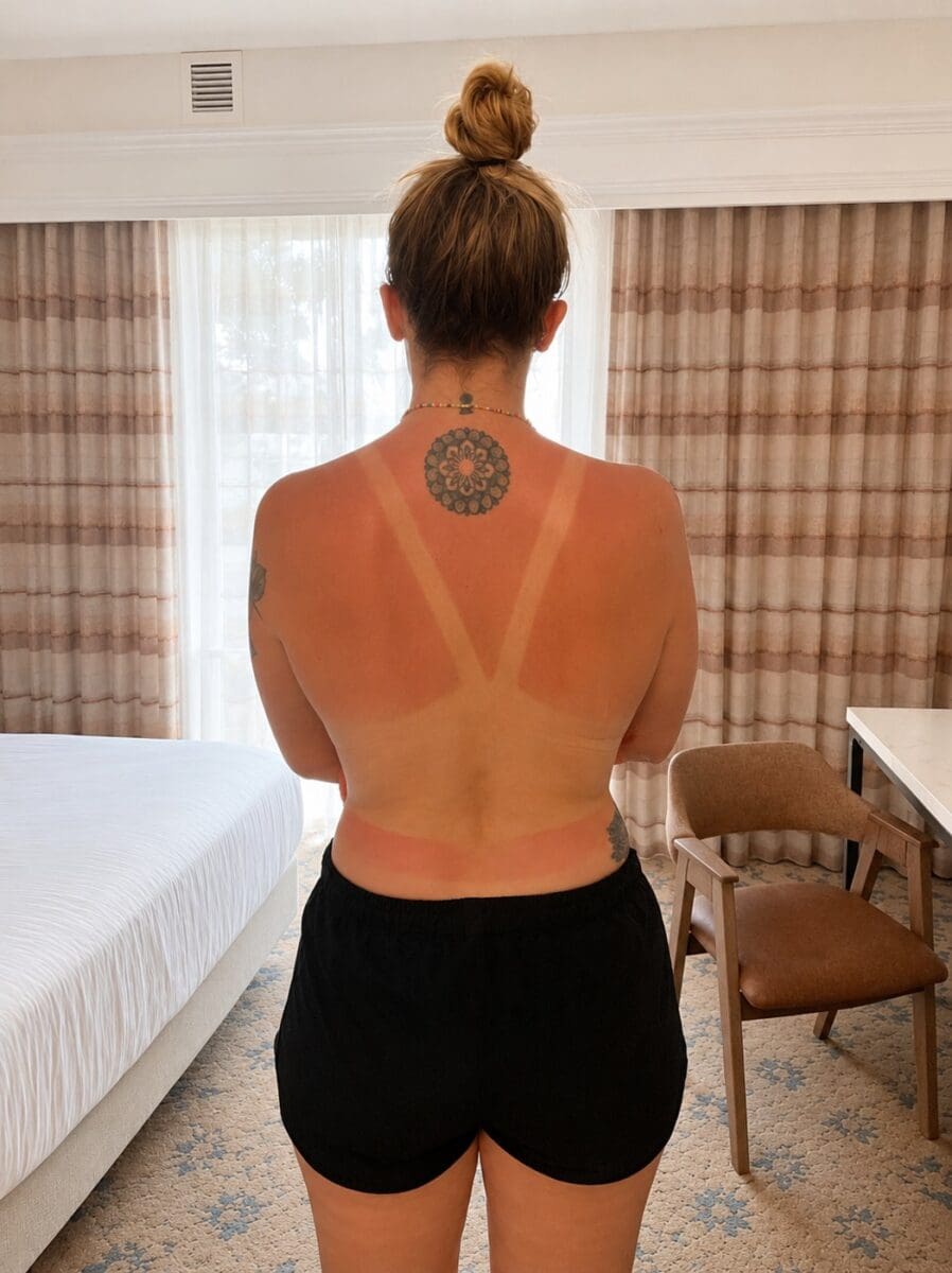 How to Even Out Tan Lines (Without Baking in More Sun)
